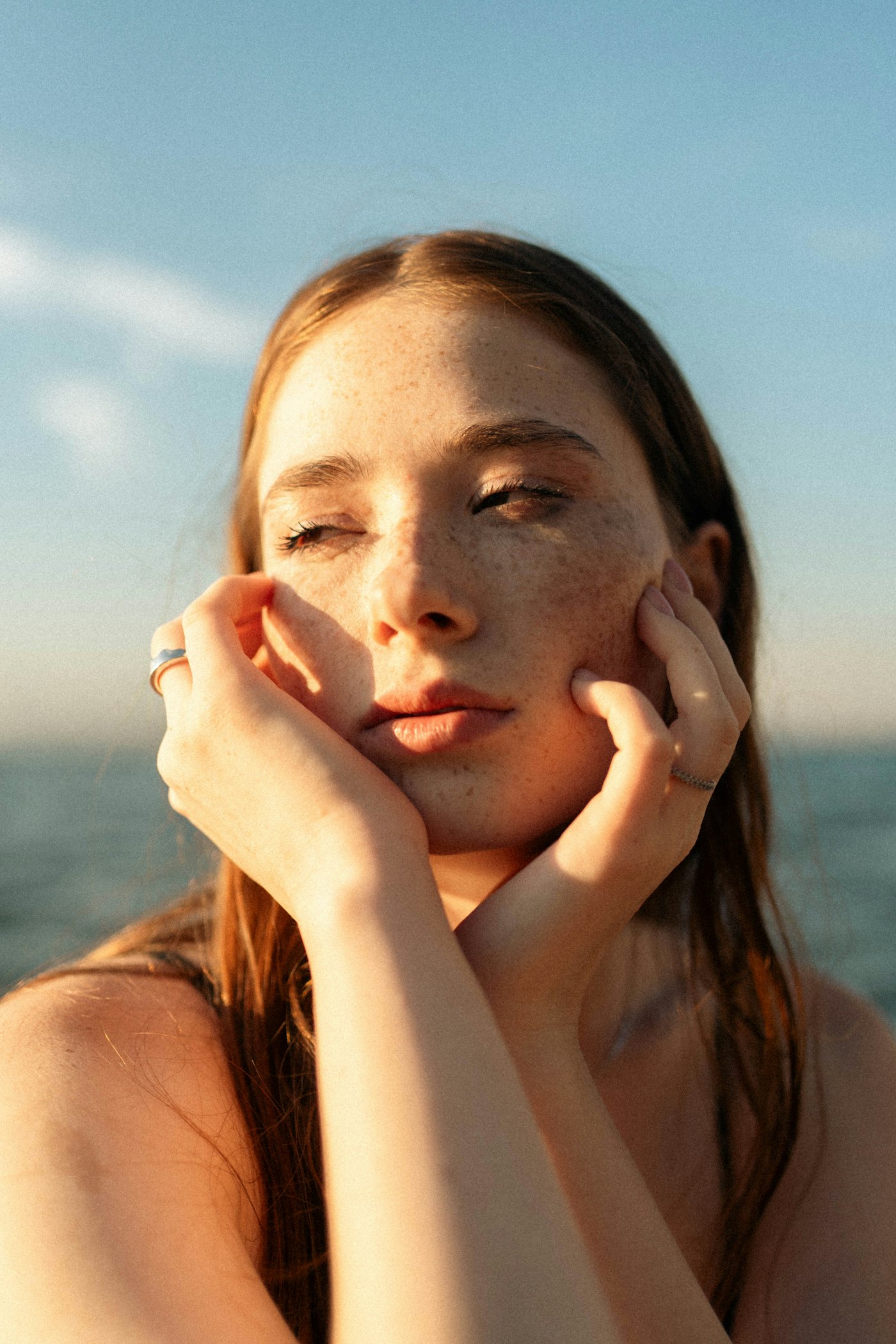 Skin boosters, under-eye, after